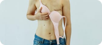 Paciente indicando área para cirugía de cáncer de mama en CDMX