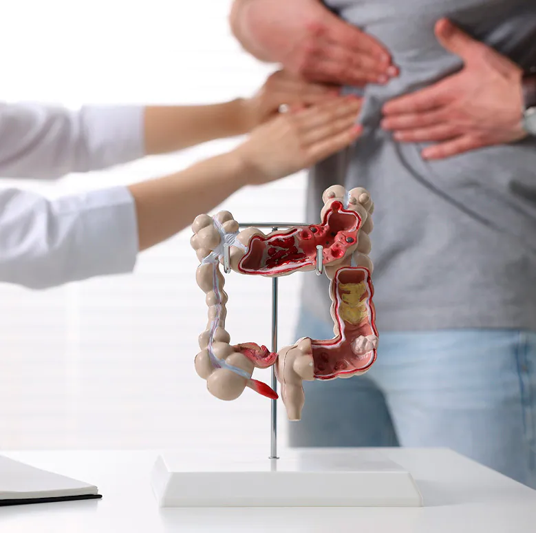 Modelo anatómico del colon durante una consulta médica