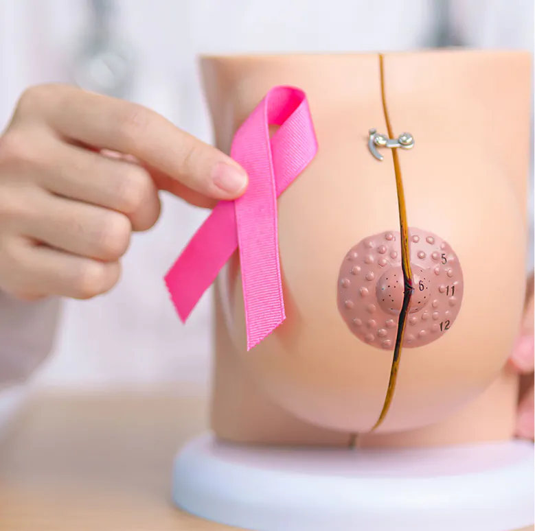 Modelo anatómico utilizado para explicar el diagnóstico de cáncer de mama
