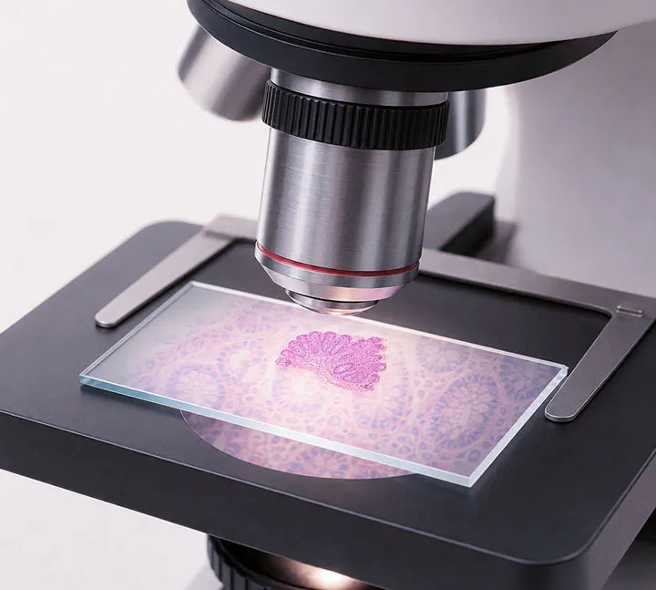 Análisis de biopsia de colon en laboratorio de patología