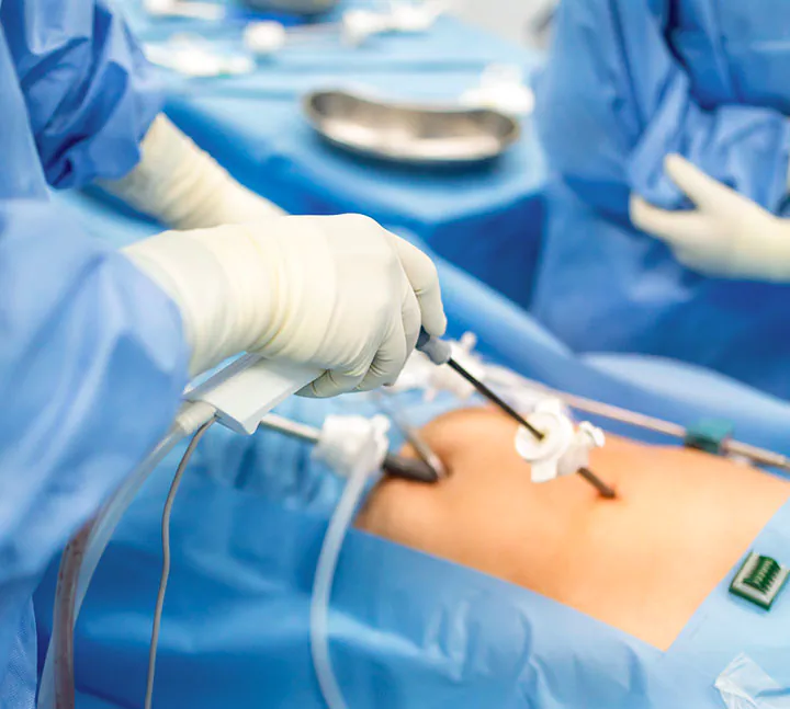 Procedimiento de colonoscopía para examinar el colon