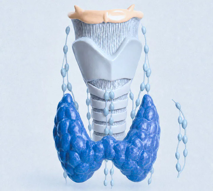 Modelo anatómico de una disección ganglionar del cuello