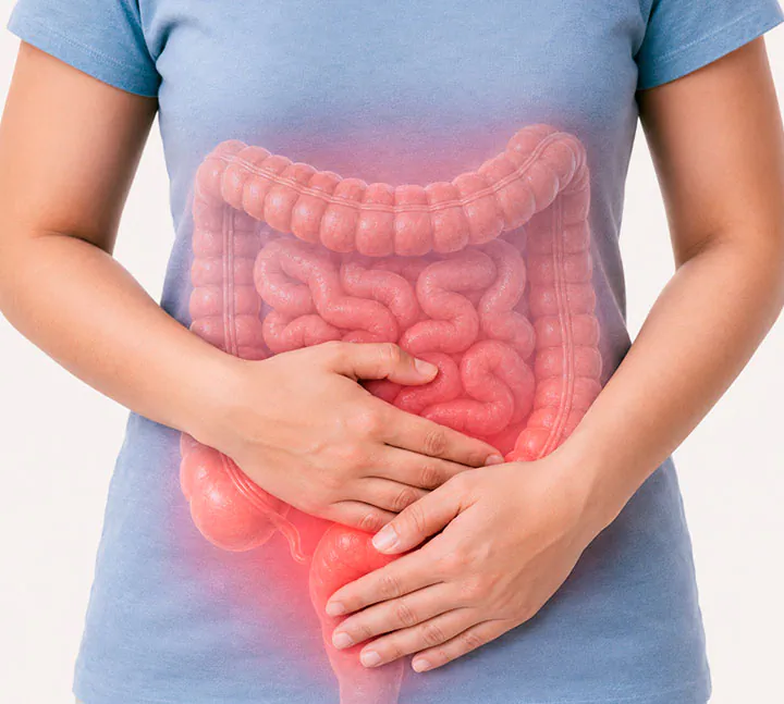 Persona con dolor abdominal e ilustración anatómica del colon